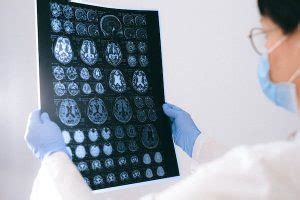 top neurologist in singapore|9 Best Neurologists In Singapore – Our Favourite List.